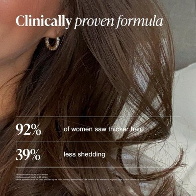 Viviscal - Hair Growth Supplements for Women, For Thinning Hair and Hair Loss -180 Comprimes - Traitement de 3 mois -